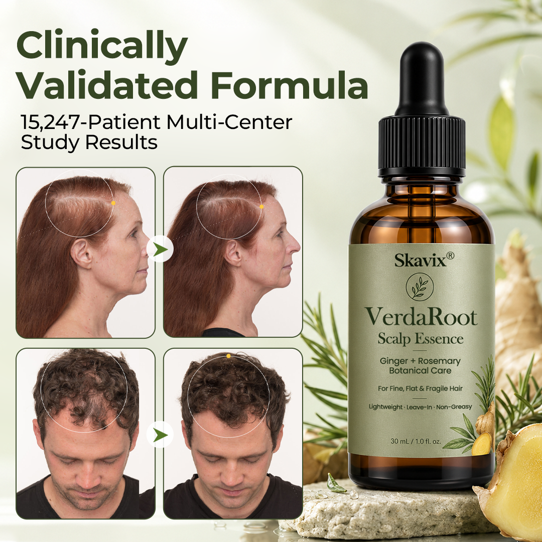 🌿 Skavix® VerdaRoot Scalp Essence – Promote Thicker, Stronger & Healthier-Looking Hair