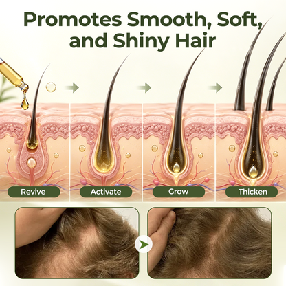 🌿 Skavix® VerdaRoot Scalp Essence – Promote Thicker, Stronger & Healthier-Looking Hair