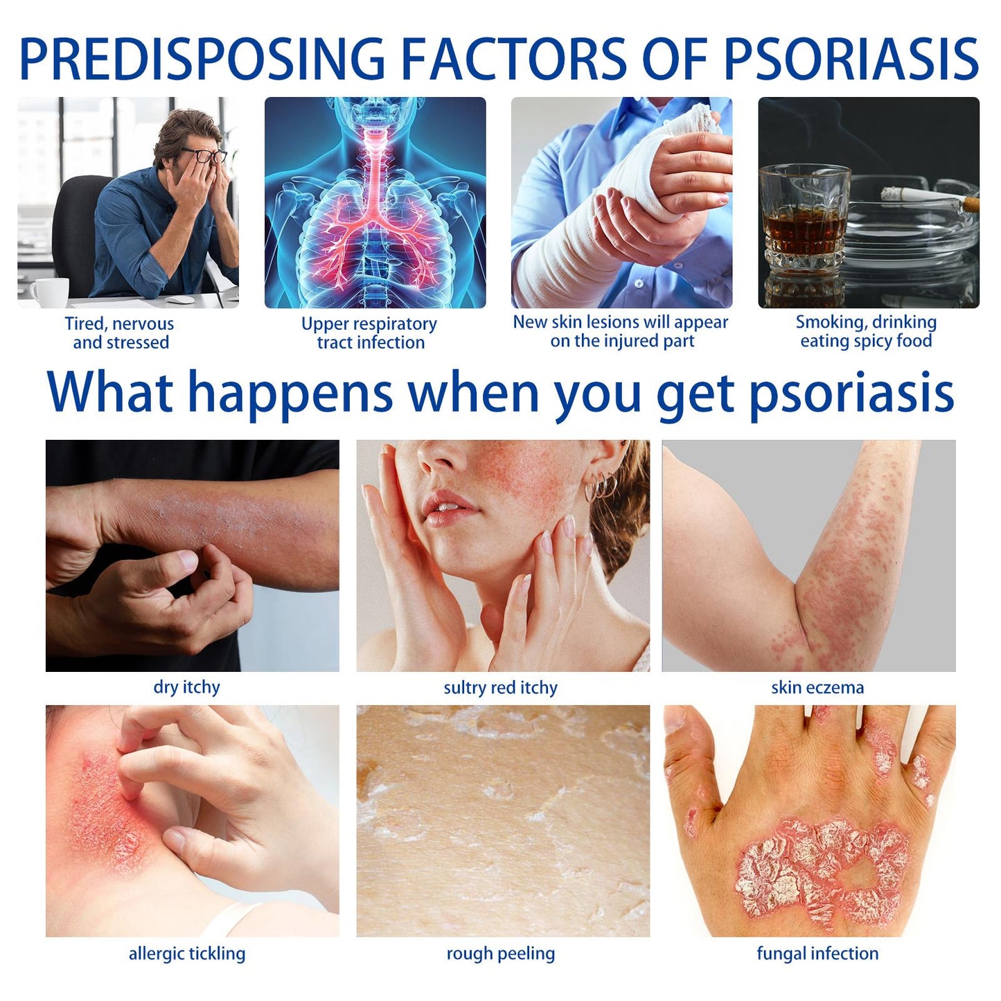 ✨ Advanced Psoriasis & Sensitive Skin Relief Cream – Calm, Hydrate & Restore Comfort