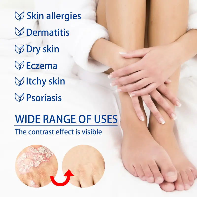 ✨ Advanced Psoriasis & Sensitive Skin Relief Cream – Calm, Hydrate & Restore Comfort